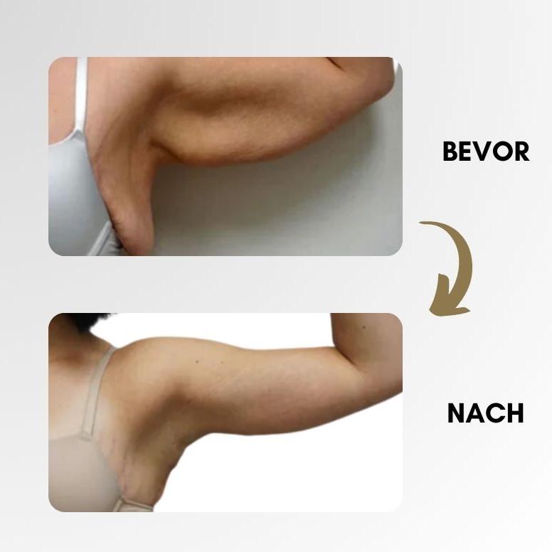 Lymphsystemanregungsring – Für bessere Durchblutung & Fettverbrennung