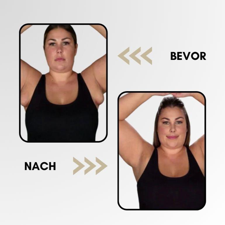 Lymphsystemanregungsring – Für bessere Durchblutung & Fettverbrennung
