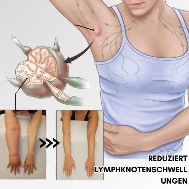 Lymphsystemanregungsring – Für bessere Durchblutung & Fettverbrennung