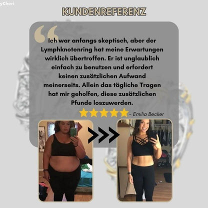 Lymphsystemanregungsring – Für bessere Durchblutung & Fettverbrennung